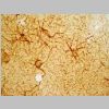 Astroglia GFAP 05.jpg